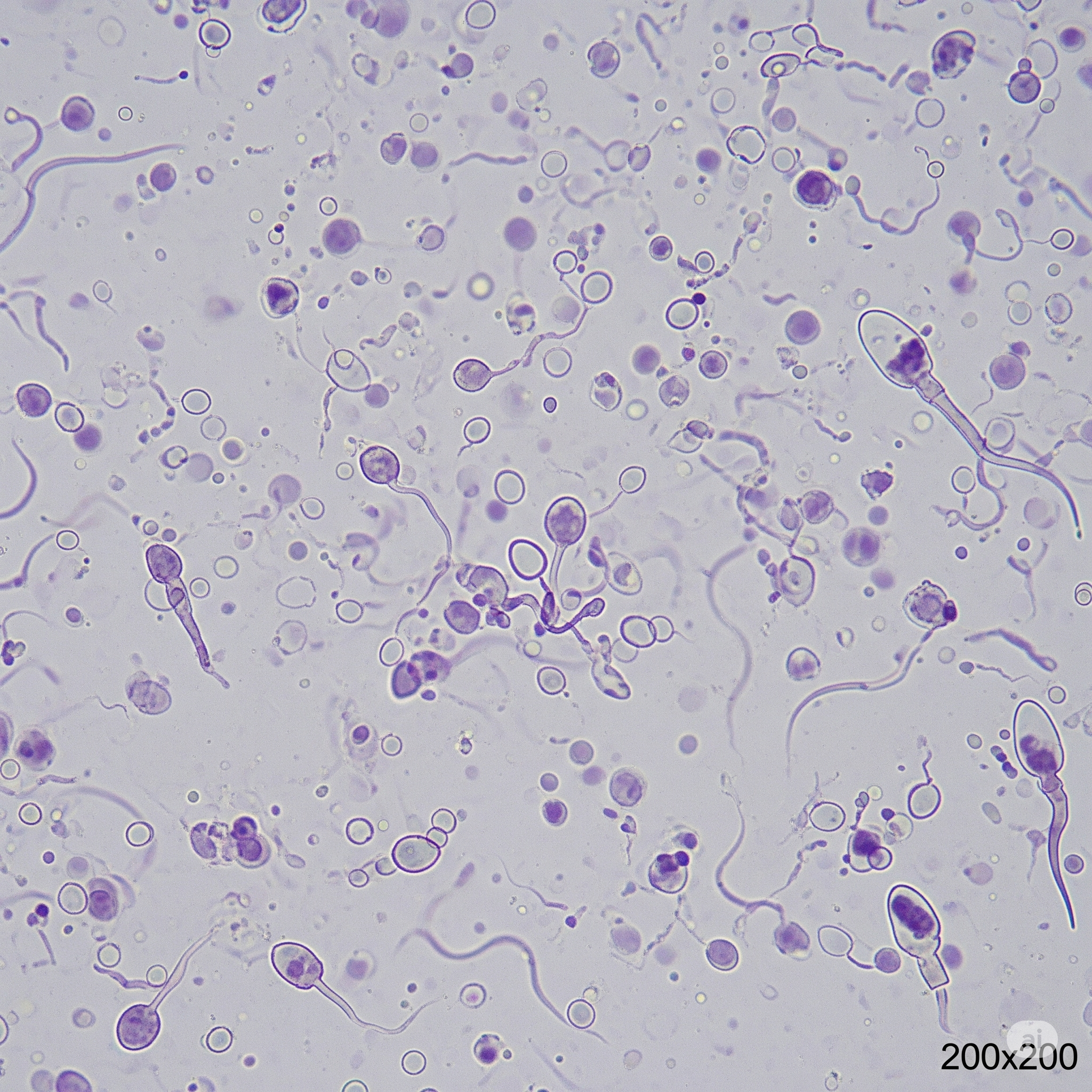 Low Sperm Motility and Morphology Evaluation